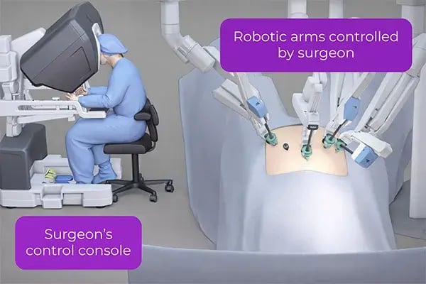 robotic-surgery-in-action-with-text