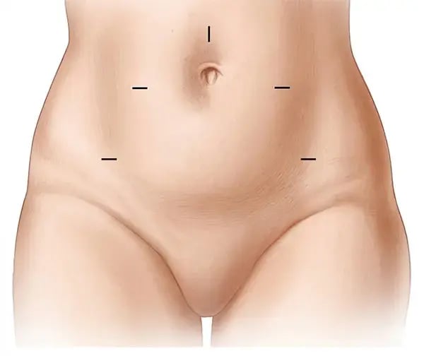 woman-abdomen-illustration