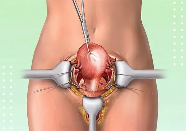 woman-surgery-illustration
